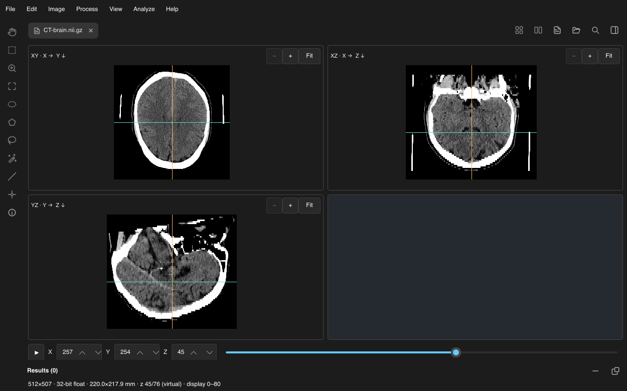 Linked voxel XY, XZ and YZ planes of the acquired CTBrain sample with a shared crosshair and anisotropic physical spacing.
