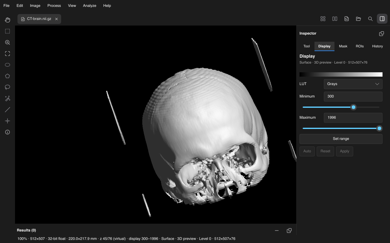 Oxel thresholded skull surface preview of CTBrain with Display minimum 300 and maximum 1996.